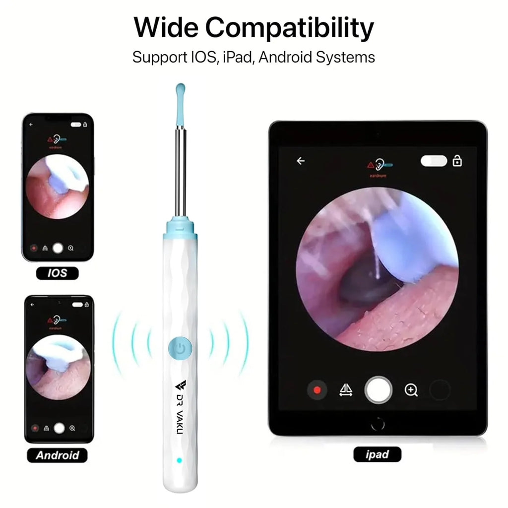 Dr. Smart Ear Cleaner Kit with HD Camera & WiFi – 6 LED Endoscope Tool for Android/iOS + 11 Free Silicone Tips (White)